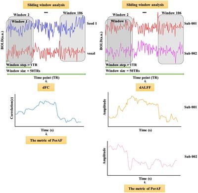 Static and dynamic resting-state brain activity patterns of table tennis players in 7-Tesla MRI